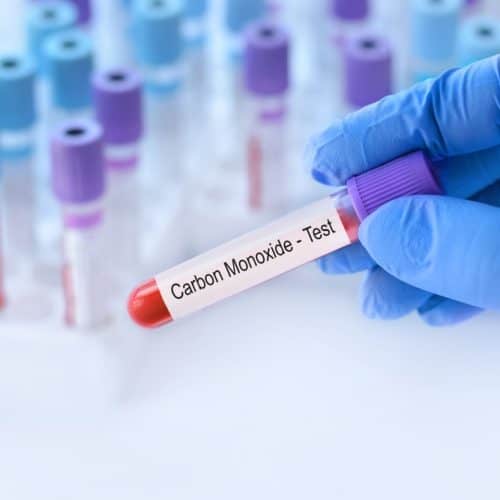 Doctor,Holding,A,Test,Blood,Sample,Tube,With,Carbon,Monoxide