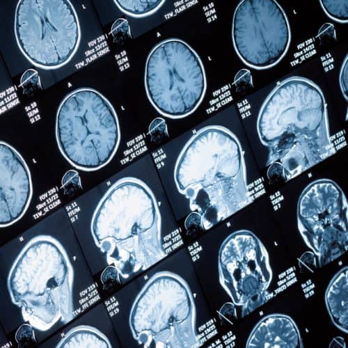 Head,And,Neck,Mri,Scan,,Anonymized,,Shallow,Focus,Depth