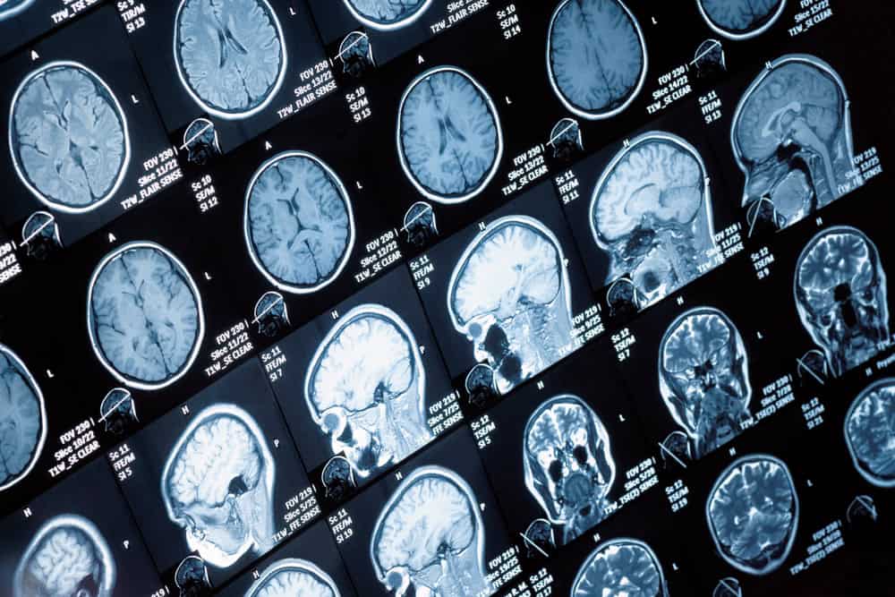 Head,And,Neck,Mri,Scan,,Anonymized,,Shallow,Focus,Depth